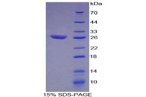 SDS-PAGE (SDS) image for Activating Transcription Factor 1 (AFT1) (AA 3-213) protein (His tag) (ABIN1879685)
