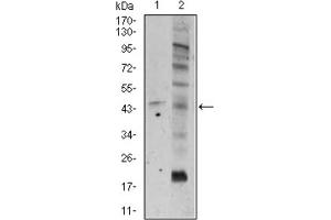 Western blot analysis using FZD5 antibody against A549 (1), and PC-3 (2) cell lysate. (FZD5 antibody  (AA 151-217))