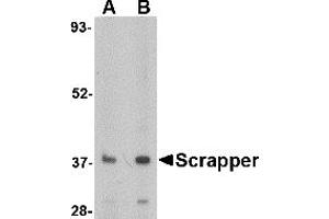Western Blotting (WB) image for anti-F-Box and Leucine-Rich Repeat Protein 20 (FBXL20) (N-Term) antibody (ABIN1031557)