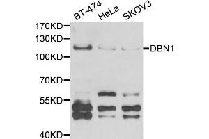 Western blot analysis of extracts of various cell lines, using DBN1 antibody (ABIN5973773) at 1/1000 dilution.