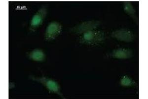 Immunostaining analysis in HeLa cells. (EIF4ENIF1 antibody)