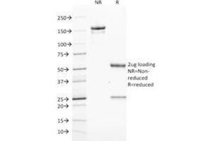 SDS-PAGE Analysis Purified ZAP70 Mouse Monoclonal Antibody (ZAP70/2046). (ZAP70 antibody  (AA 247-382))