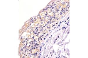 Paraformaldehyde-fixed, paraffin embedded human bladder tissue, Antigen retrieval by boiling in sodium citrate buffer (pH6. (BID antibody)