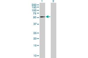 Western Blot analysis of ZNF136 expression in transfected 293T cell line by ZNF136 MaxPab polyclonal antibody. (ZNF136 antibody  (AA 1-540))