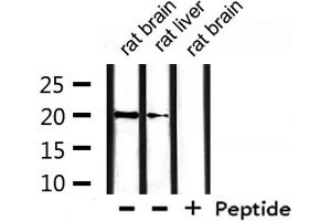 Western Blotting (WB) image for anti-HCG beta antibody (ABIN6262161)