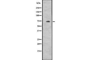 Western blot analysis of CYLC1 expression in Hela cell lysate,The lane on the left is treated with the antigen-specific peptide. (CYLC1 antibody)