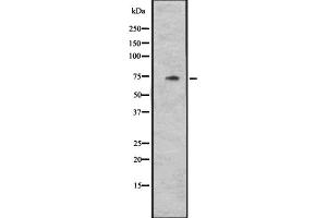 Western blot analysis of CYLC1 expression in Hela cell lysate,The lane on the left is treated with the antigen-specific peptide.
