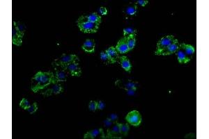 Immunofluorescence staining of HepG2 cells with ABIN7162435 at 1:100, counter-stained with DAPI. (P-Selectin antibody  (AA 543-767))