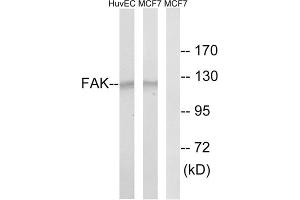 Western blot analysis of extracts from HUVEC cells and MCF-7 cells, using FAK (epitope around residue 843) antibody. (FAK antibody)