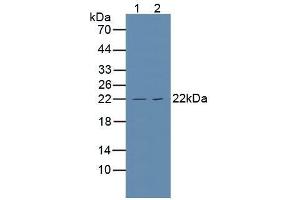 Figure. (TNFRSF1A antibody  (AA 248-428))