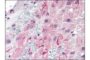 Image no. 1 for anti-Secreted phosphoprotein 1 (SPP1) (C-Term) antibody (ABIN372777) (Osteopontin antibody  (C-Term))
