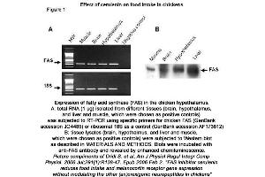 Image no. 1 for anti-Fatty Acid Synthase (FASN) (N-Term) antibody (ABIN363338)