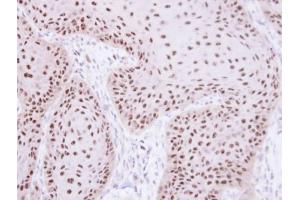 Immunohistochemistry (IHC) image for anti-Replication Protein A1, 70kDa (RPA1) (C-Term) antibody (ABIN2856633)