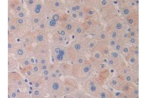 Immunohistochemistry (IHC) image for anti-Histone Deacetylase 6 (HDAC6) (AA 166-348) antibody (ABIN7435907)