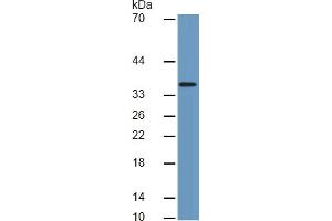 Mouse Capture antibody from the kit in WB with Positive Control:  Human heart lysate. (CTGF ELISA Kit)