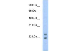 Western Blotting (WB) image for anti-Cytoplasmic Polyadenylated Homeobox (CPHX) antibody (ABIN2461548) (CPHX antibody)