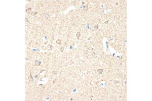 Immunohistochemistry of paraffin-embedded human brain using Guanylyl Cyclase beta 1 (GUCY1B3) (GUCY1B3) Rabbit mAb (ABIN7267551) at dilution of 1:100 (40x lens). (GUCY1B3 antibody)