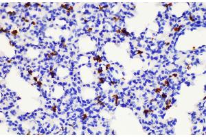 Immunohistochemistry of paraffin-embedded Mouse lung using S100a8 Polycloanl Antibody at dilution of 1:200