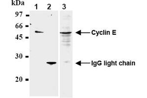 Western Blotting (WB) image for anti-Cyclin E1 (CCNE1) antibody (ABIN567784) (Cyclin E1 antibody)