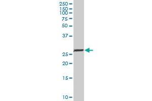 NKX2-5 monoclonal antibody (M01), clone 1E4-G5. (NK2 Homeobox 5 antibody  (AA 1-324))