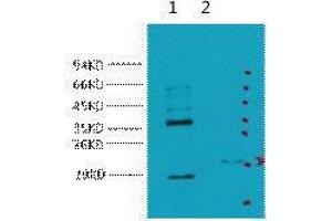 Western Blot (WB) analysis of 1) HeLa, 2) 293T, diluted at 1:5000. (CA9 antibody)