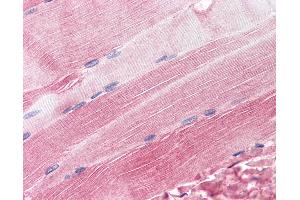 Anti-RAPSN / RAPSYN antibody IHC of human skeletal muscle. (RAPSN antibody  (AA 395-412))