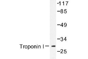 Image no. 1 for anti-Cardiac Troponin I (TNNI3) antibody (ABIN272087) (TNNI3 antibody)