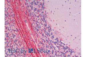 ABIN2613474 (5µg/ml) staining of paraffin embedded Human Cerebellum. (Robo3.2  (AA 1303-1316) antibody)