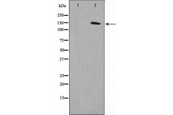 Meningioma 1 antibody  (Internal Region)