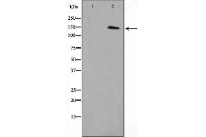 Western blot analysis on COLO205 cell lysate using MN1 Antibody,The lane on the left is treated with the antigen-specific peptide.