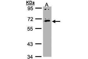 WB Image Sample(30 ug whole cell lysate) A:HeLa S3, 7. (IL17RC antibody)