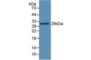 Detection of Recombinant MHCDRa, Simian using Monoclonal Antibody to HLA Class II Histocompatibility Antigen, DR Alpha Chain (HLA-DRA) (HLA-DRA antibody  (AA 28-232))