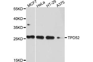 Western blot analysis of extracts of various cell lines, using TPD52 antibody. (TPD52 antibody)