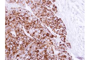 IHC-P Image Immunohistochemical analysis of paraffin-embedded HT29 xenograft, using Cytokeratin 20, antibody at 1:100 dilution. (KRT20 antibody)