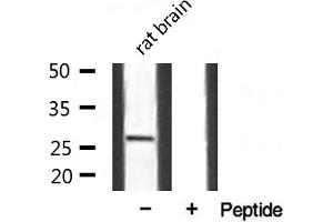 Western blot analysis of extracts from mouse Brian, using SPIC antibody. (SPIC antibody  (Internal Region))