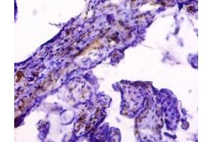 Immunohistochemistry of paraffin-embedded human placenta tissue using ABIN7155551 at dilution of 1:50 (HLAG antibody  (AA 25-337))