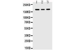 Anti-VEGF Receptor 1 antibody, Western blotting Lane 1: MCF-7 Cell Lysate Lane 2: SGC Cell Lysate Lane 3: MM231 Cell Lysate (FLT1 antibody  (C-Term))