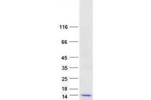 Validation with Western Blot (VKORC1 Protein (Transcript Variant 2) (Myc-DYKDDDDK Tag))