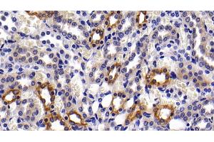 Immunohistochemistry (IHC) image for anti-Keratin 6A (KRT6A) (AA 163-468) antibody (ABIN7435445)