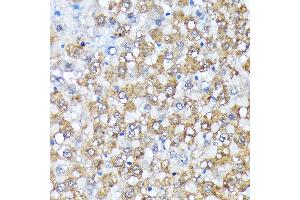 Immunohistochemistry of paraffin-embedded rat liver using Casein Kinase 1 alpha (Casein Kinase 1 alpha (CSNK1)) Rabbit mAb (ABIN7266098) at dilution of 1:100 (40x lens). (CSNK1A1 antibody)