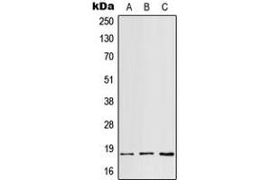 Western blot analysis of RPS18 expression in HepG2 (A), mouse spleen (B), H9C2 (C) whole cell lysates. (RPS18 antibody  (Center))