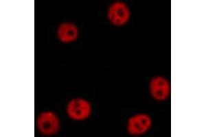 ABIN6274458 staining HepG2 cells by IF/ICC. (TAF15 antibody  (Internal Region))