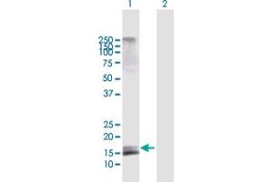AGTRAP antibody  (AA 1-152)