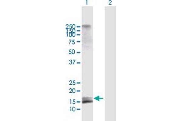 AGTRAP 抗体  (AA 1-152)