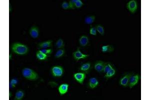 Immunofluorescent analysis of MCF-7 cells using ABIN7165422 at dilution of 1:100 and Alexa Fluor 488-congugated AffiniPure Goat Anti-Rabbit IgG(H+L) (FAM156A antibody  (AA 1-153))