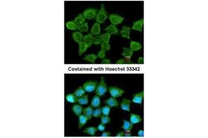 ICC/IF Image Immunofluorescence analysis of methanol-fixed A431, using SUCLA2, antibody at 1:200 dilution. (SUCLA2 antibody)