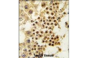 Formalin-fixed and paraffin-embedded human testis tissue reacted with GDF3 antibody (Center) (ABIN388819 and ABIN2839137) , which was peroxidase-conjugated to the secondary antibody, followed by DAB staining. (GDF3 antibody  (AA 170-197))