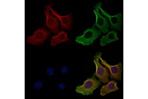 ABIN6262540 and ABIN6278895 staining Hela cells by IF/ICC. (IL17F antibody  (Internal Region))