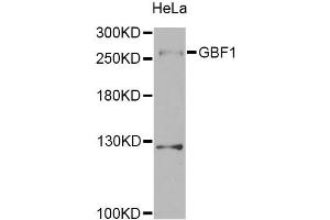 Western blot analysis of extracts of HeLa cells, using GBF1 Antibody. (GBF1 antibody)