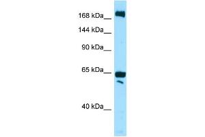 WB Suggested Anti-WNK2 Antibody Titration: 1.
